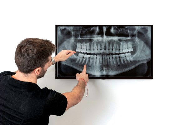 How Preventive Dentistry Can Catch Signs Of Oral Cancer